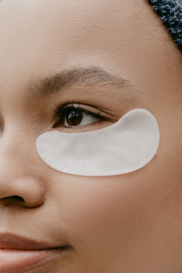 Effective Under Eye Treatment: Uncover Radiant Solutions for Dark Circles