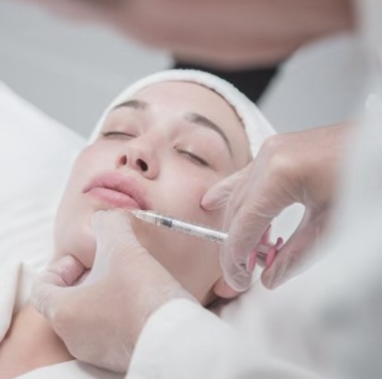 Lip Augmentation