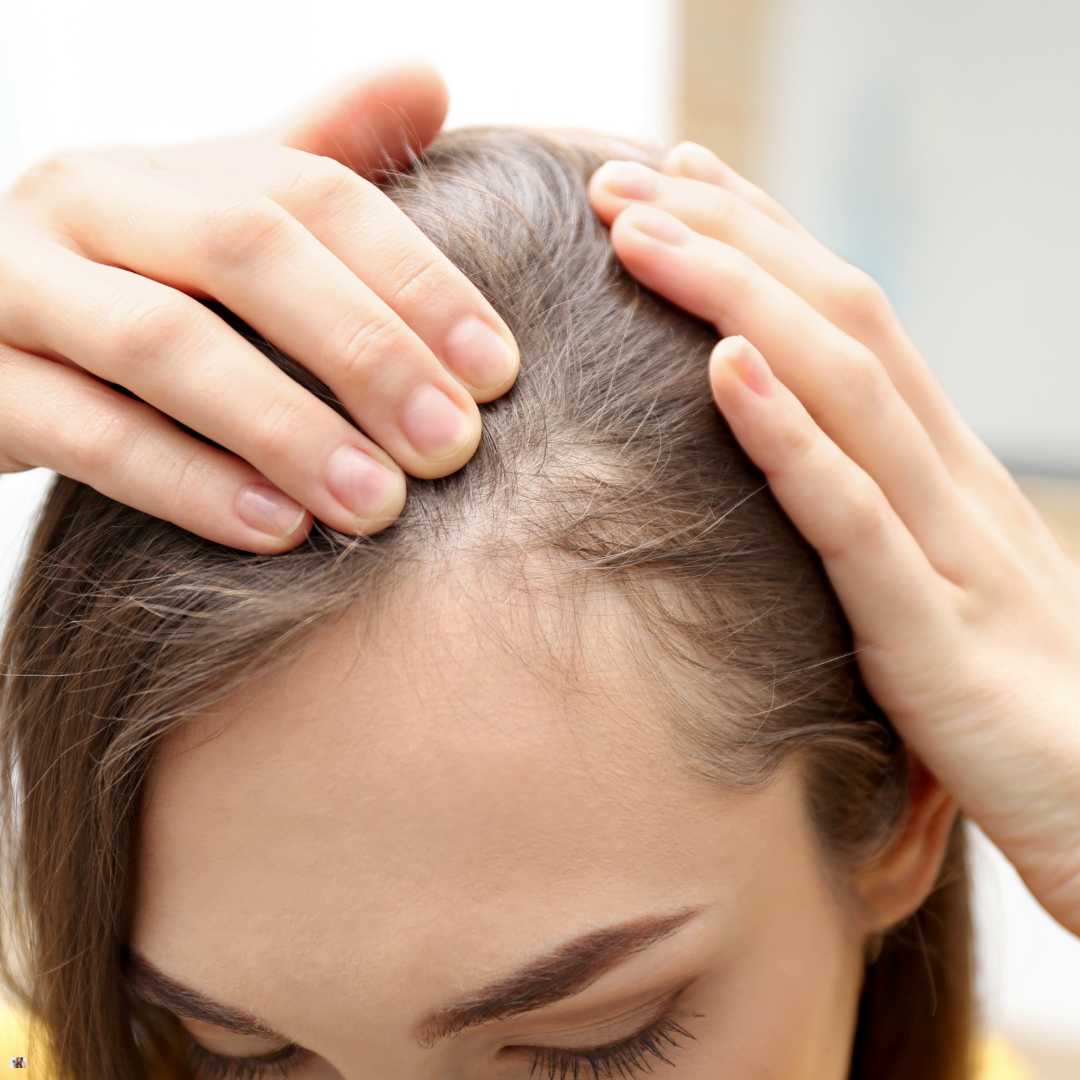 Hair Loss Treatment