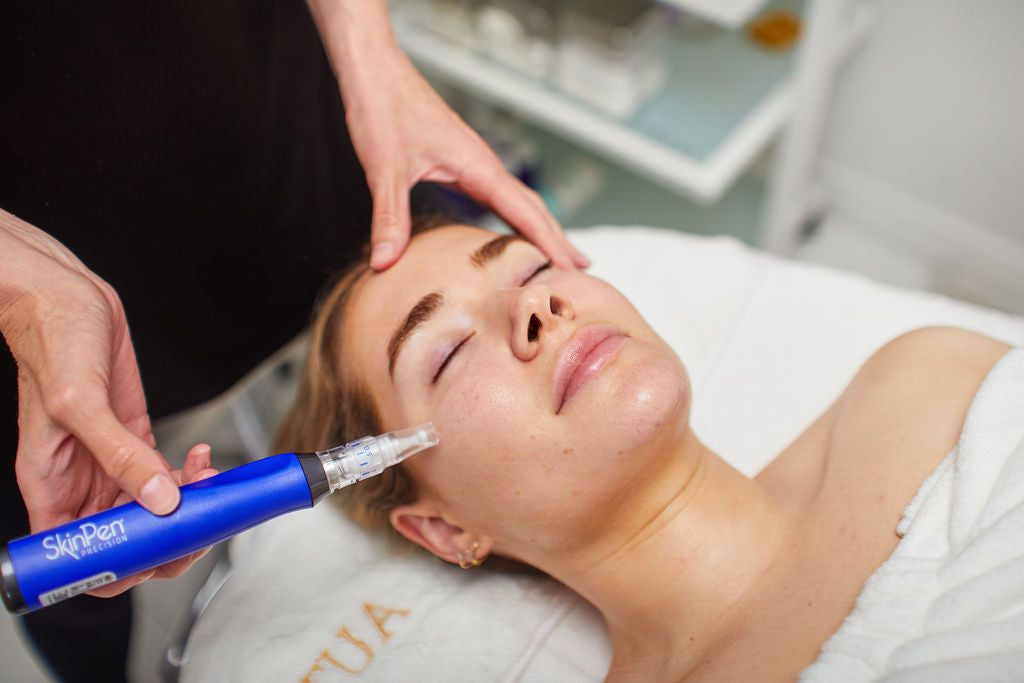 Microneedling